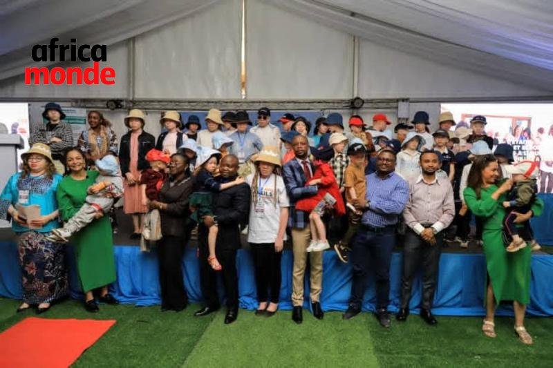 Les enfants albinos lors dela remise des chapeaux et autres 